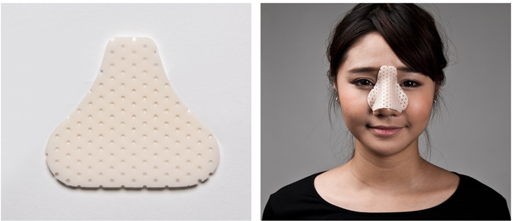 klarity nasal splints thermoplastic.jpg