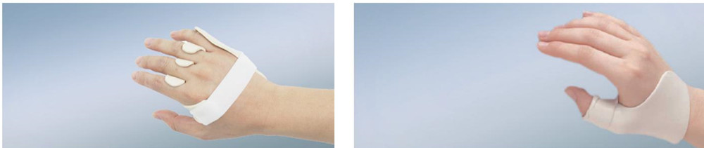 orthosis and splint.jpg